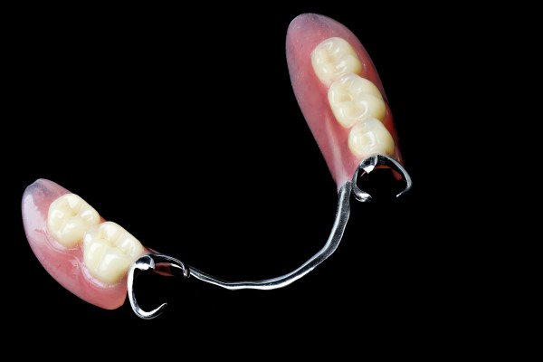 Dental Bridges