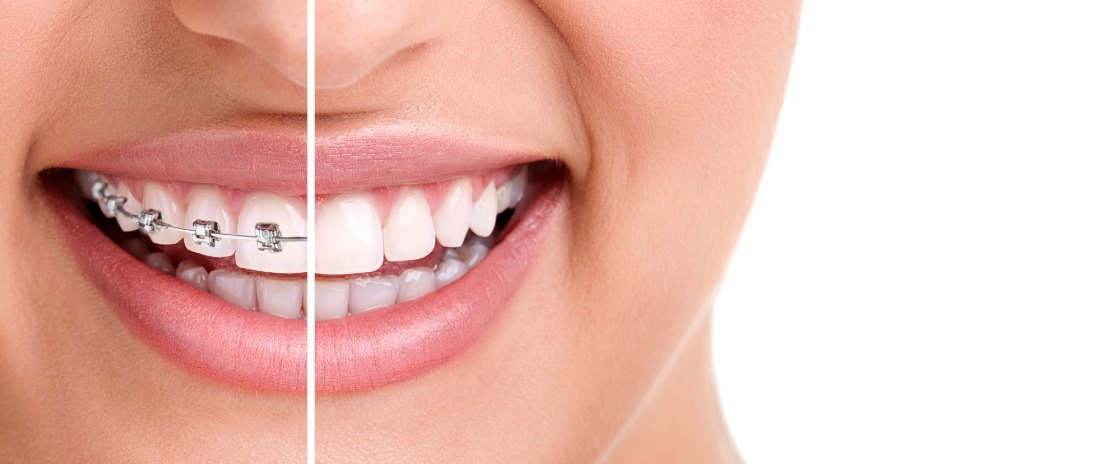Cosmetic treatment in garia, patuli